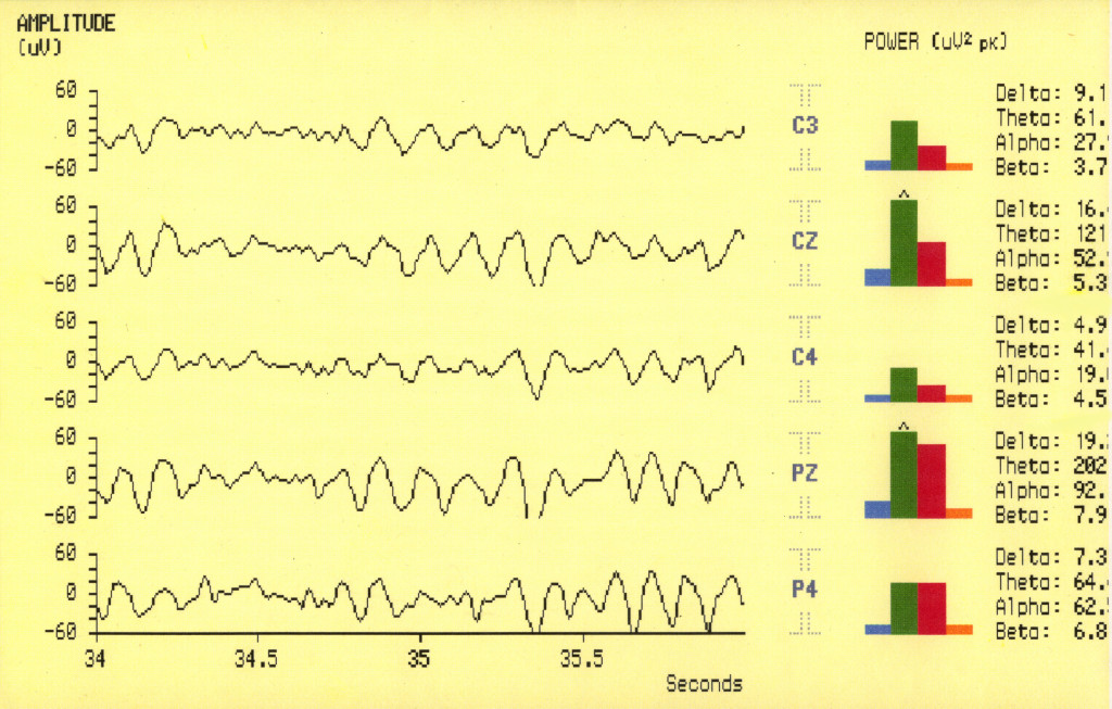 Brain States 1